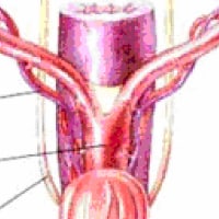 Ovariohysterectomy