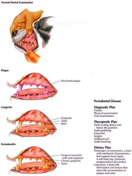 Periodontal Disease