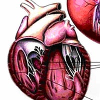 Canine Dilated Cardiomyopathy