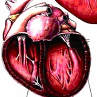 Feline Dilated Cardiomyopathy