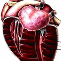 Feline Hypertrophic Cardiomyopathy