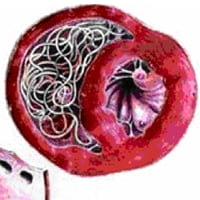 Heartworm Disease
