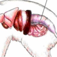 Constipation/Colonic Impaction