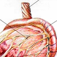 Gastric Dilation with Volvulus