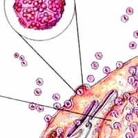 Parvoviral Enteritis
