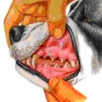 Periodontal Disease