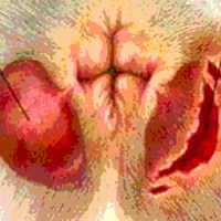 Anal Sac Abscess