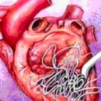 Heartworms