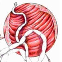Tapeworms (Dipylidium caninum)