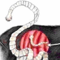 Tapeworms (Taenia)