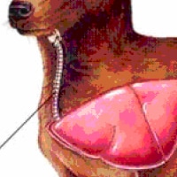 Collapsing Trachea