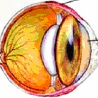 Corneal Ulceration