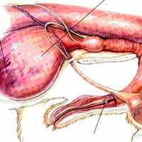 Canine Urethral Obstruction