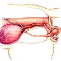 Feline Lower Urinary Tract Disease